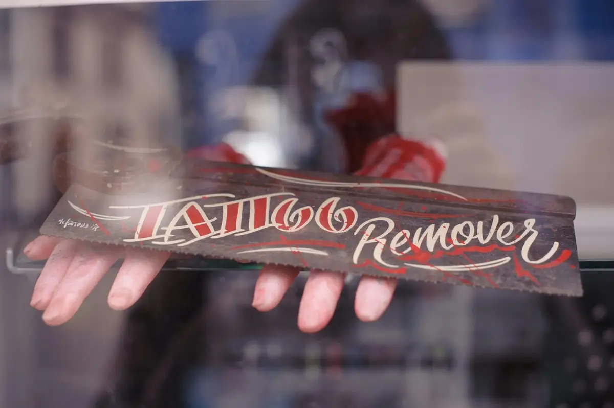 What to Expect from Professional Laser Tattoo Removal Services